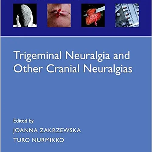 Trigeminal Neuralgia and Other Cranial Neuralgias: A Practical Personalised Holistic Approach (Oxford Pain Management Library)
