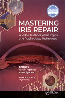 Mastering Iris Repair A Video Textbook of Iris Repair and Pupilloplasty Techniques