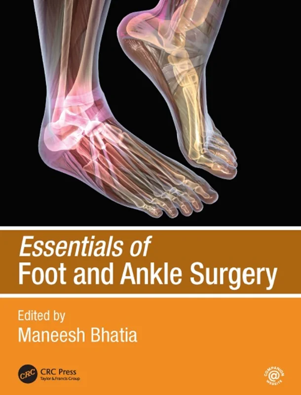 Essentials of Foot and Ankle Surgery