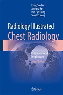 Radiology Illustrated: Chest Radiology (2nd ed.) Pattern Approach for Lung Imaging