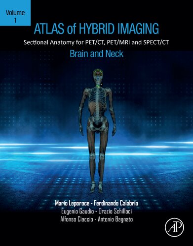 Atlas of Hybrid Imaging Sectional Anatomy for PET/CT, PET/MRI and SPECT/CT Vol. 1: Brain and Neck: Sectional Anatomy for PET/CT, PET/MRI and SPECT/CT