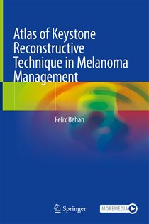 Atlas of Keystone Reconstructive Technique in Melanoma Management