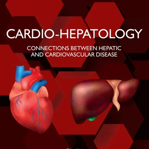 Cardio-Hepatology: Connections Between Hepatic and Cardiovascular Disease