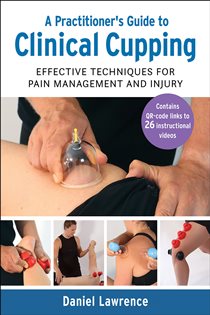 A Practitioner's Guide to Clinical Cupping Effective Techniques for Pain Management and Injury