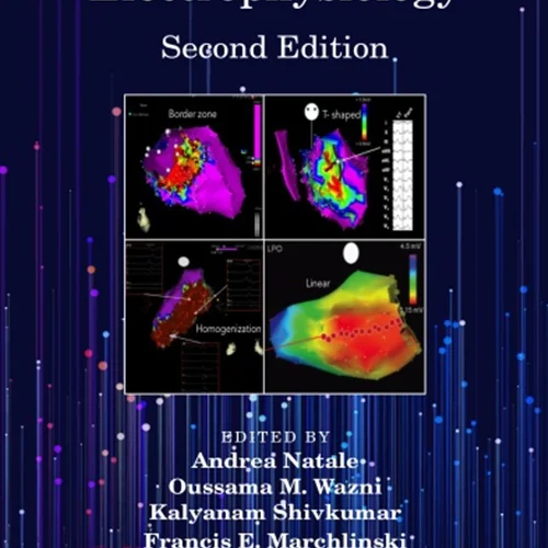 Handbook of Cardiac Electrophysiology, 2nd Edition