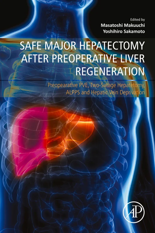 Safe Major Hepatectomy after Preoperative Liver Regeneration: Preopearative PVE, Two-Satage Hepatetomy, ALPPS and Hepatic Vein Deprivation