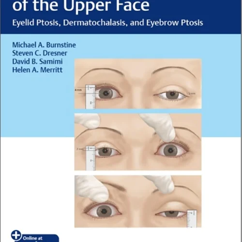 دانلود کتاب جراحی پلاستیک چشمی صورت فوقانی: پتوز پلک (افتادگی پلک)، درماتوچالاز (پوست اضافی در پلک) و پتوز ابرو (افتادگی ابرو)
