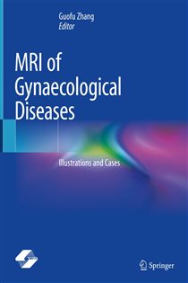 MRI of Gynaecological Diseases Illustrations and Cases