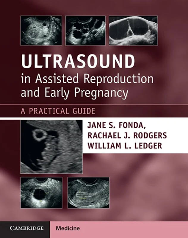Ultrasound in Assisted Reproduction and Early Pregnancy: A Practical Guid