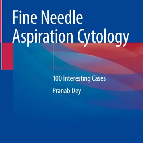 Fine Needle Aspiration Cytology: 100 Interesting Cases