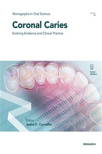 Coronal Caries Evolving Evidence and Clinical Practice