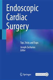 Endoscopic Cardiac Surgery Tips, Tricks and Traps