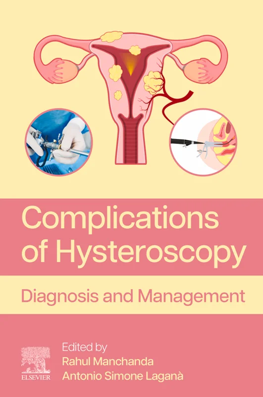 Complications of Hysteroscopy: Diagnosis and Management