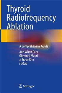 Thyroid Radiofrequency Ablation A Comprehensive Guide