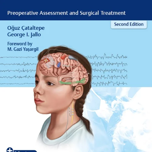 دانلود کتاب جراحی صرع کودکان: ارزیابی قبل از عمل و درمان جراحی