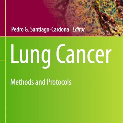 دانلود کتاب سرطان ریه: روش ها و پروتکل ها