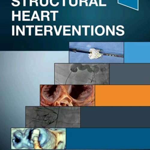 Handbook of Structural Heart Interventions