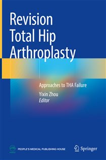 Revision Total Hip Arthroplasty Approaches to THA Failure