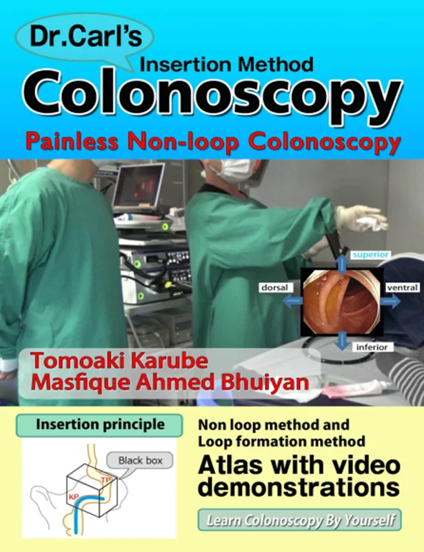 Dr. Carl's Colonoscopy insertion method: Painless Non-loop Colonoscopy
