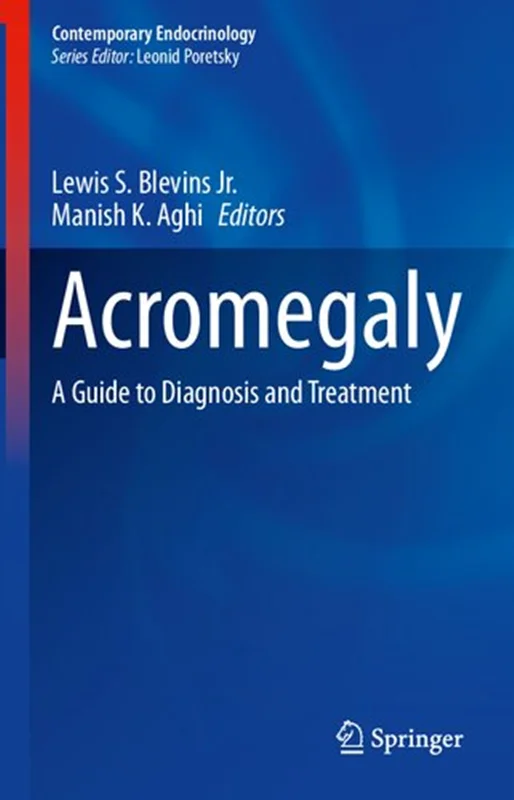 Acromegaly: A Guide to Diagnosis and Treatment