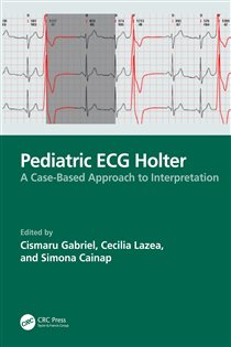 Pediatric ECG Holter A Case-Based Approach to Interpretation