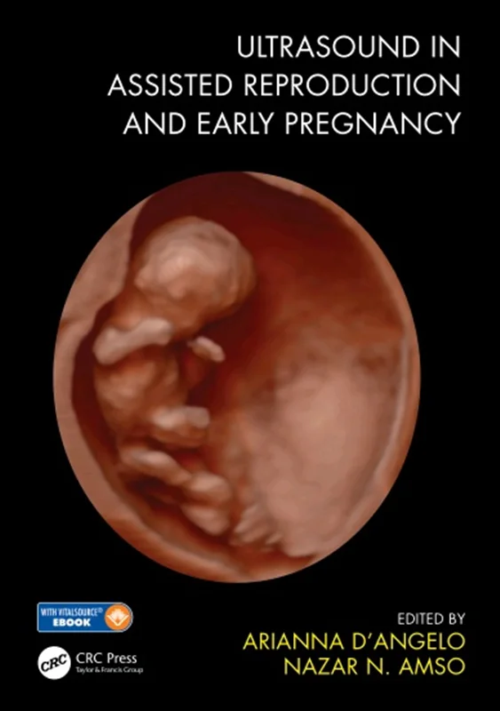 دانلود کتاب سونوگرافی در تولید مثل کمکی و اوایل بارداری