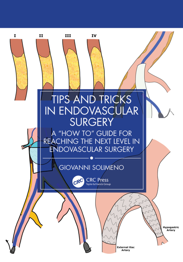 Tips and Tricks in Endovascular Surgery: A "How to" Guide for reaching the next Level in Endovascular Surgery