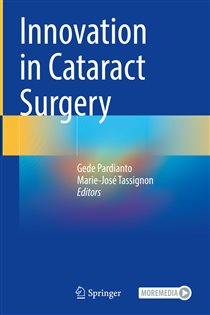 Innovation in Cataract Surgery