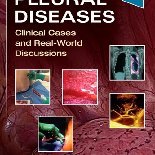 Pleural Diseases: Clinical Cases and Real-World Discussion