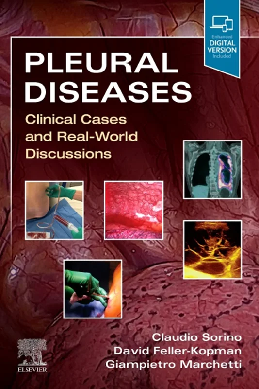 Pleural Diseases: Clinical Cases and Real-World Discussion