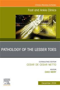 Pathology of the Lesser Toes, An issue of Foot and Ankle Clinics of North America, E-Book