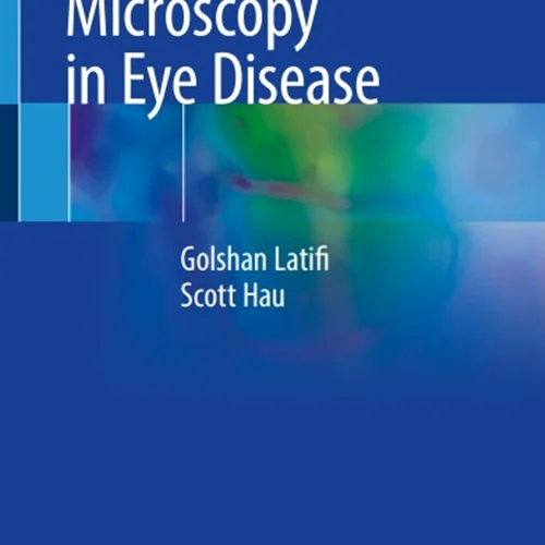 In Vivo Confocal Microscopy in Eye Disease