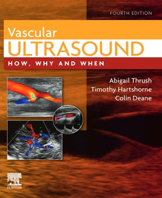Vascular Ultrasound: How, Why and When