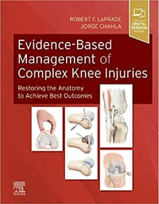 Evidence-Based Management of Complex Knee Injuries: Restoring the Anatomy to Achieve Best Outcomes