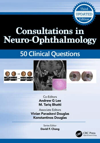 Consultations in Neuro-Ophthalmology 50 Clinical Questions Edited By Andrew Lee, M. Tariq Bhatti