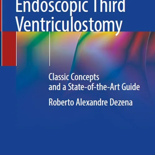 Endoscopic Third Ventriculostomy: Classic Concepts and a State-of-the-Art Guide