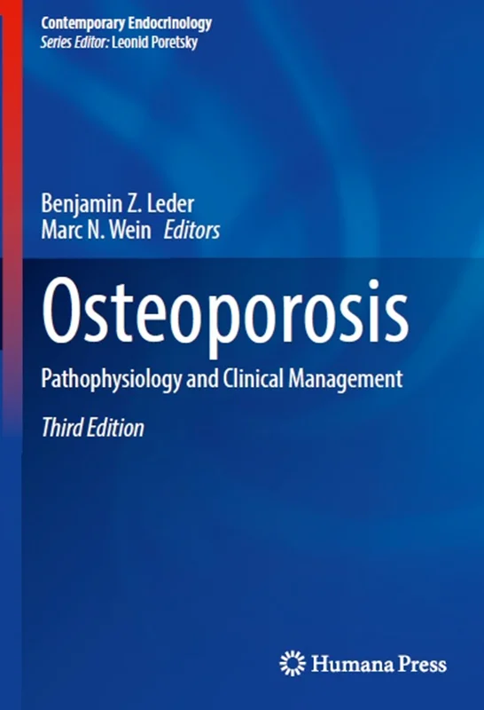 دانلود کتاب پوکی استخوان (اوستئوپوروسیس): پاتوفیزیولوژی و مدیریت بالینی