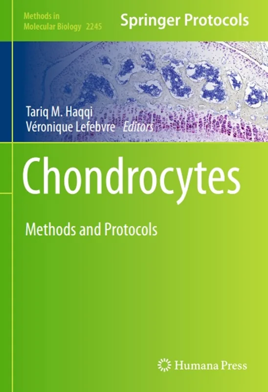 Chondrocytes: Methods and Protocols