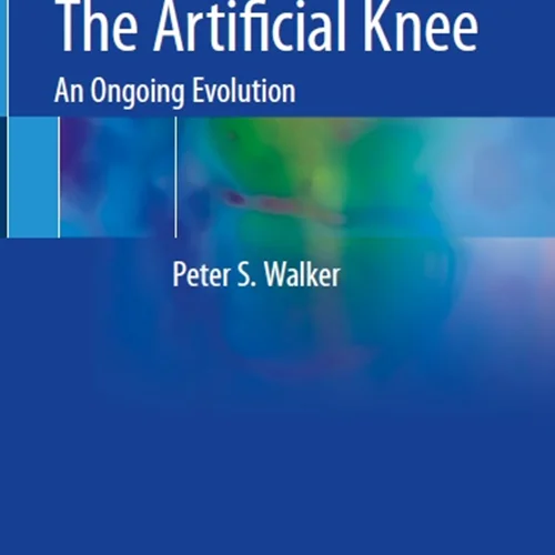 The Artificial Knee: An Ongoing Evolution